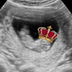Image for article titled Kate Middleton's Fetus Is Palace Property